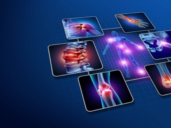 FİBROMYALJİ(FİBROMİYALJİ)